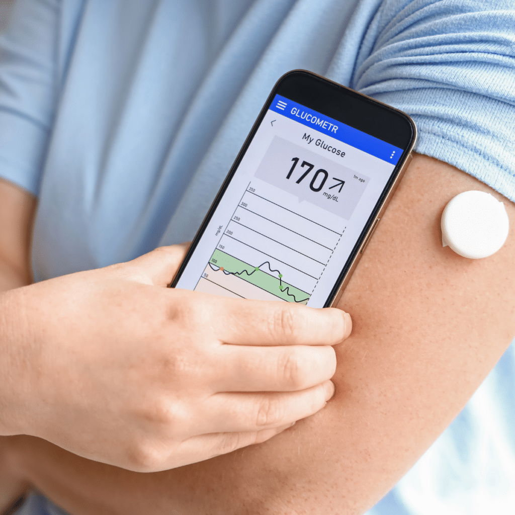 Insulin Pump Therapy